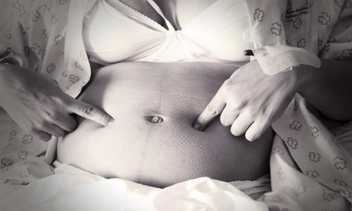 Как да си върнете тялото след раждането