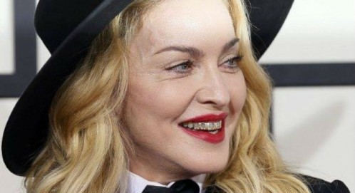 Мадона с брекети